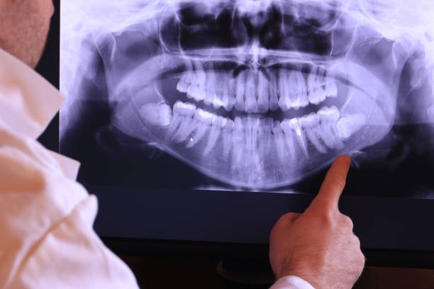 Best Emergency Dental Surgery in Granger, WA